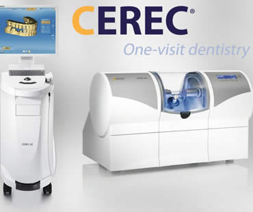 Frequently Asked Questions About CEREC