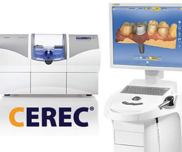 Can You Benefit from CEREC?