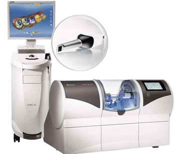Features of CEREC Technology for Crowns